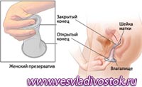 ЖЕНСКИЙ ПРЕЗЕРВАТИВ